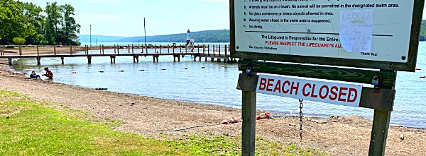 Myers Park Beach Closed